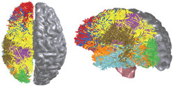 brain map